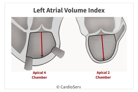 left atrial volume index calculator.